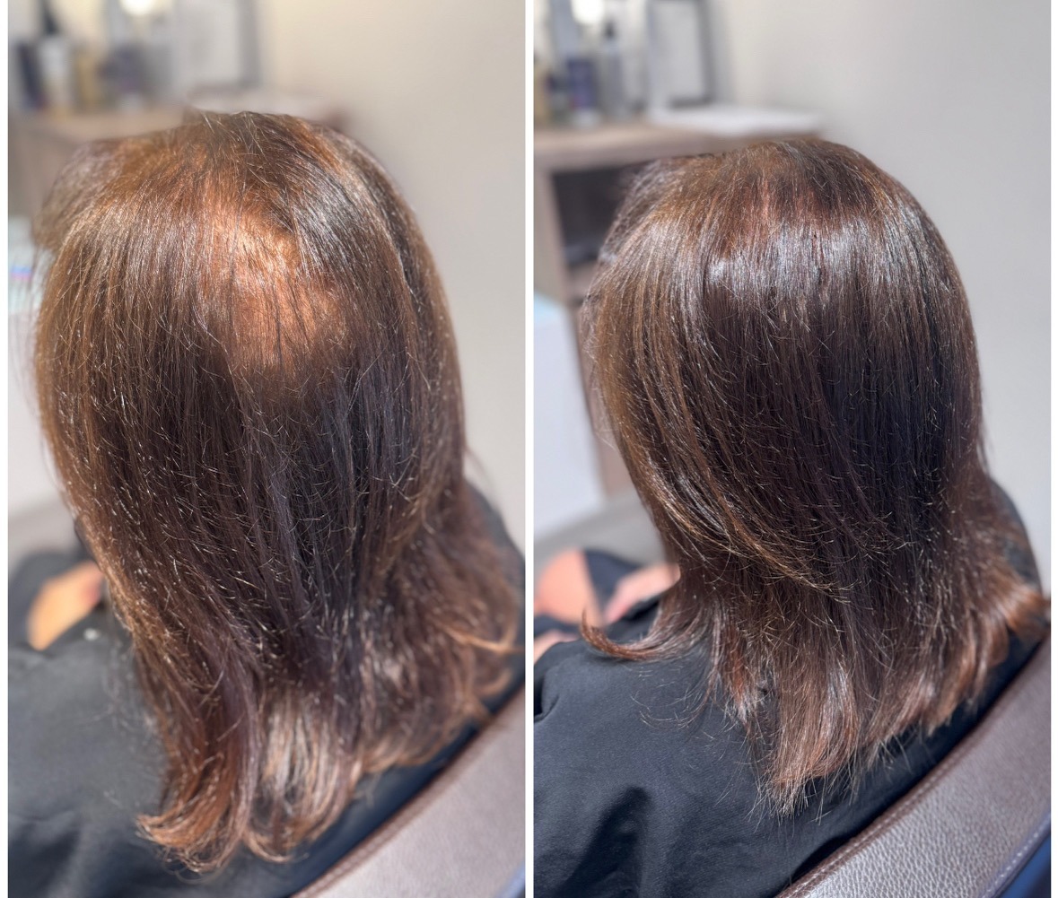before-and-after comparison
